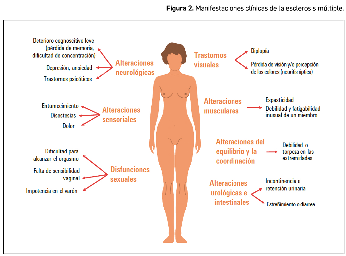 Revision_Esclerosis_Figura2